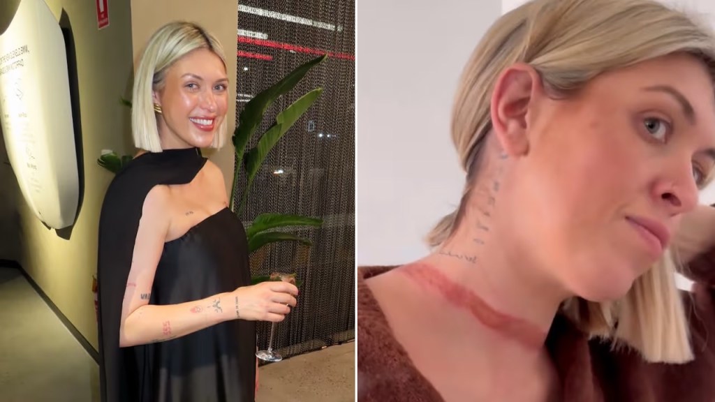 Influencer australiana sufre accidente con su bufanda y lanza advertencia en&nbsp;redes